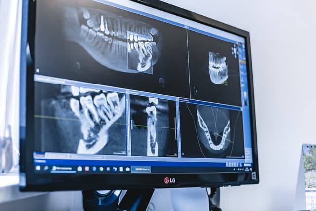 Diş informatikası: telemedisin və elektron sağlamlıq qeydləri (EHR)